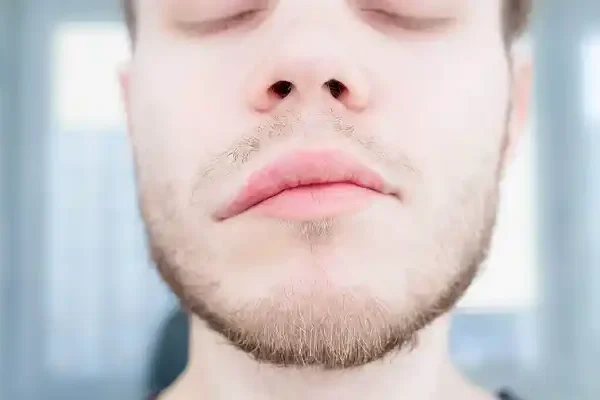 yuz-felci