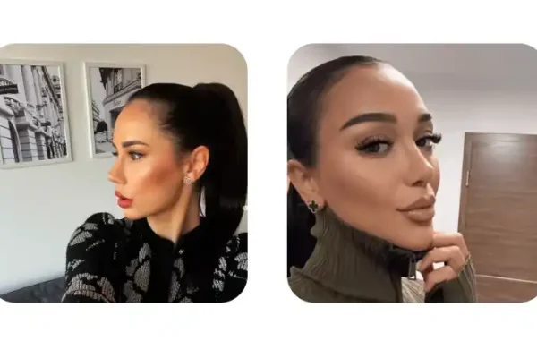 Burun Estetiği Fiyatları